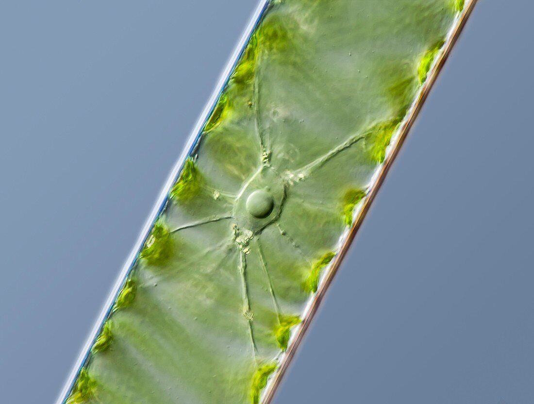 Spirogyra green alga,LM