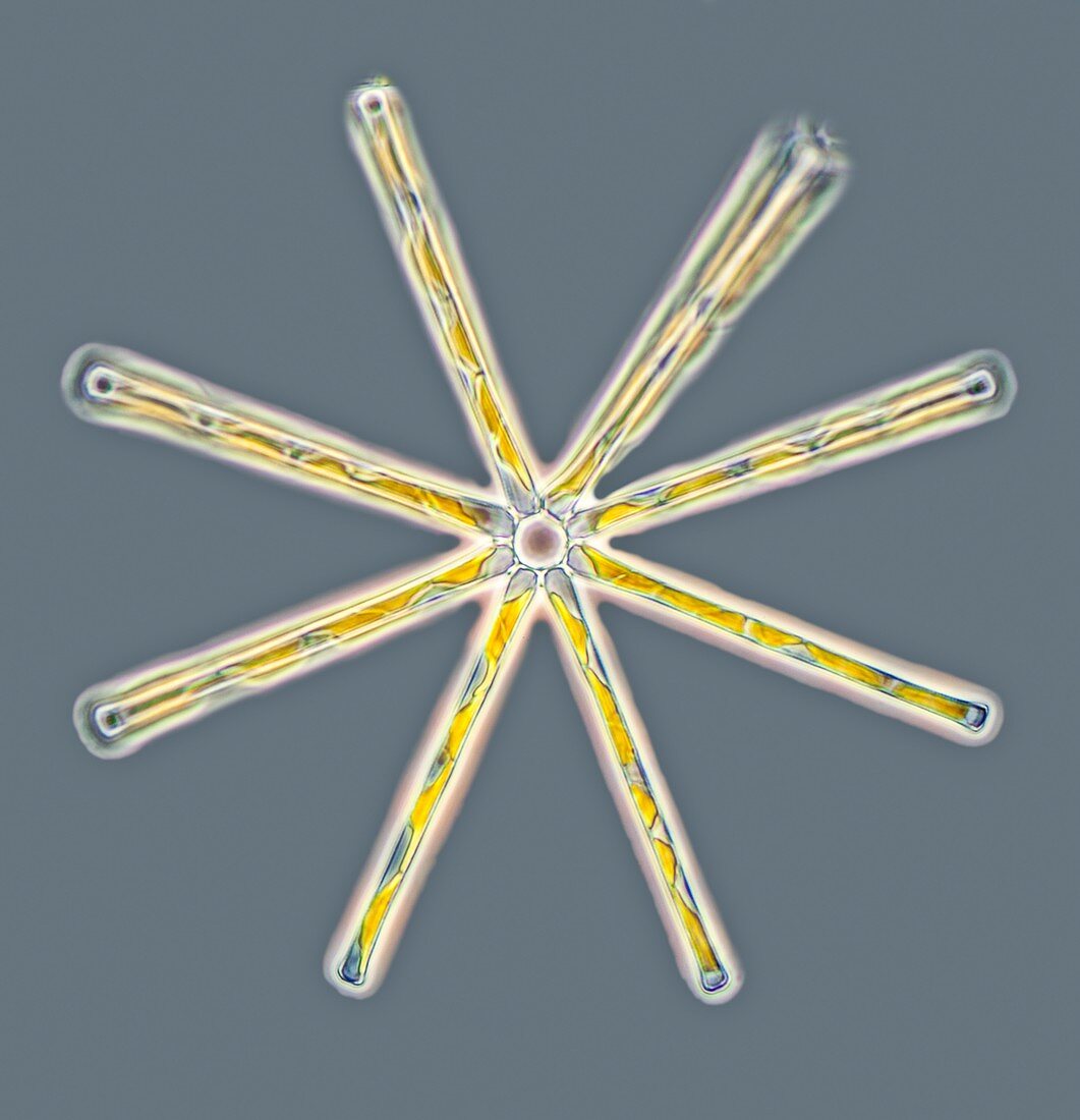 Asterionella diatoms,LM