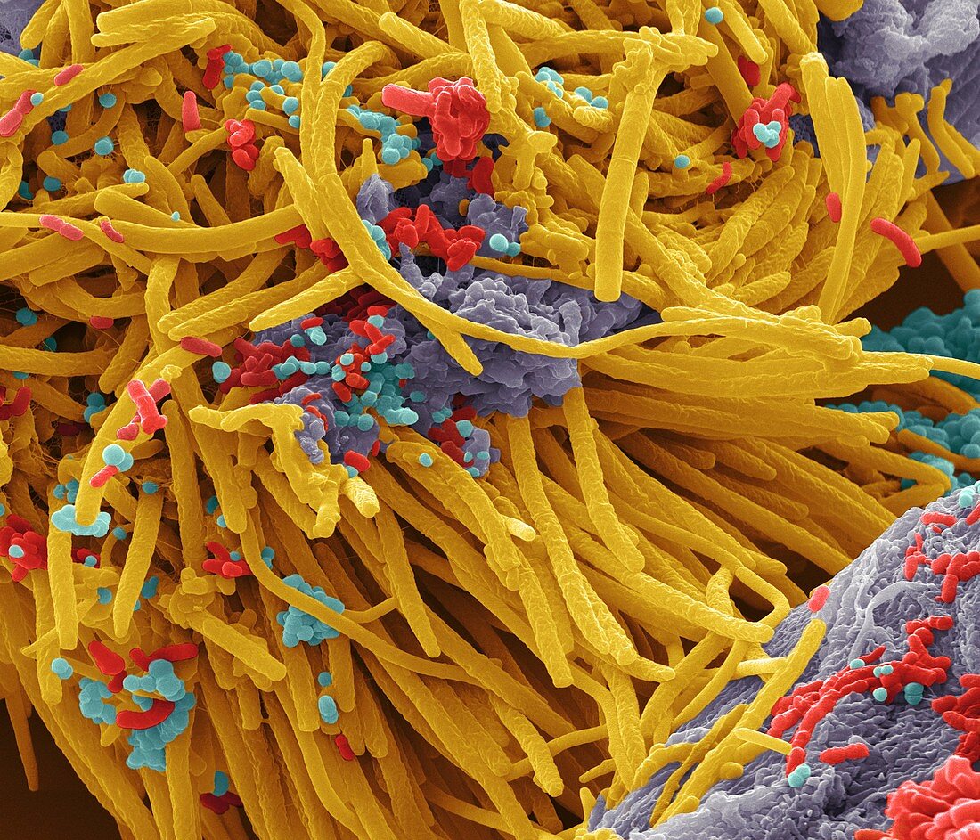 Oral bacteria,SEM