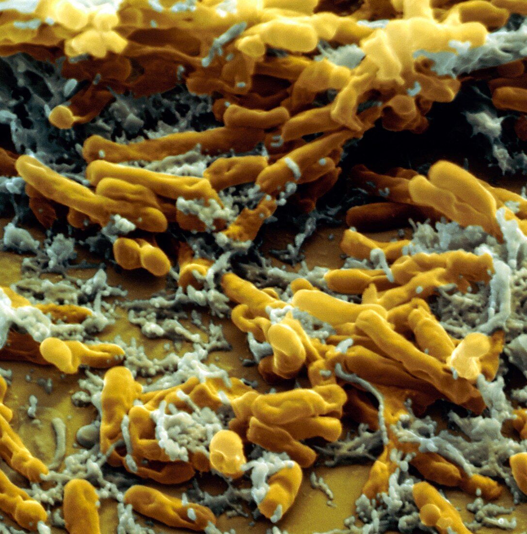 LM of a colony of Clostridium botulinum