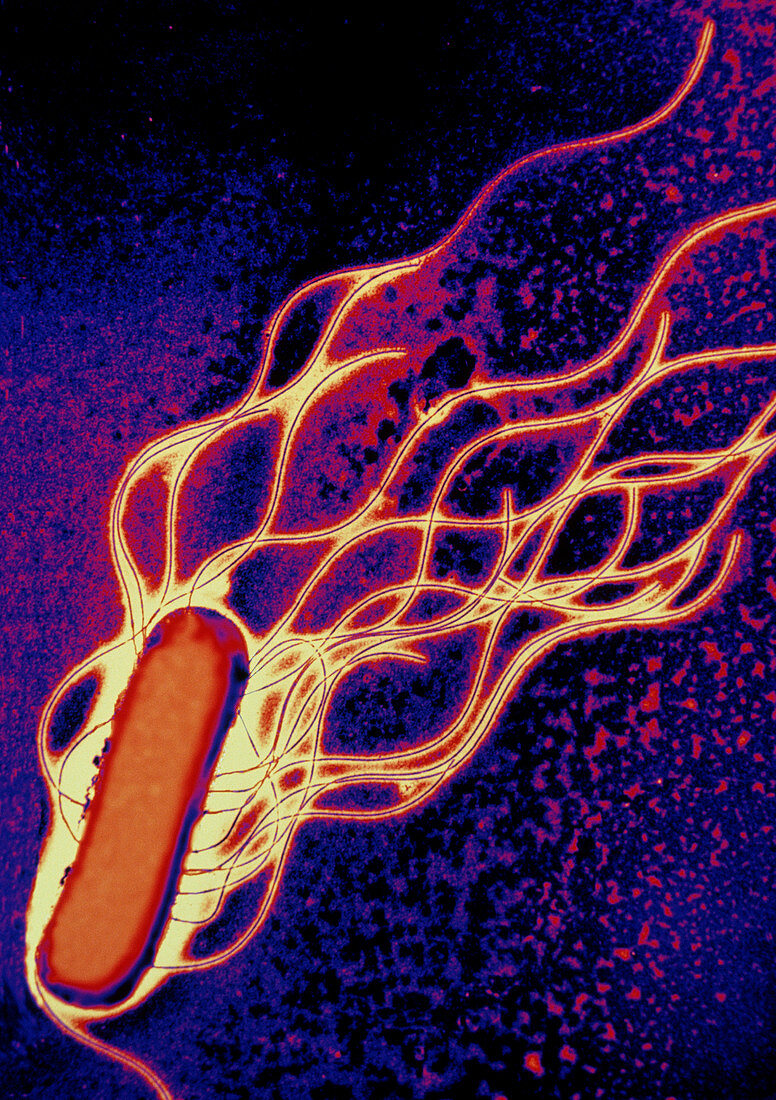 Coloured TEM of Salmonella sp. bacteria