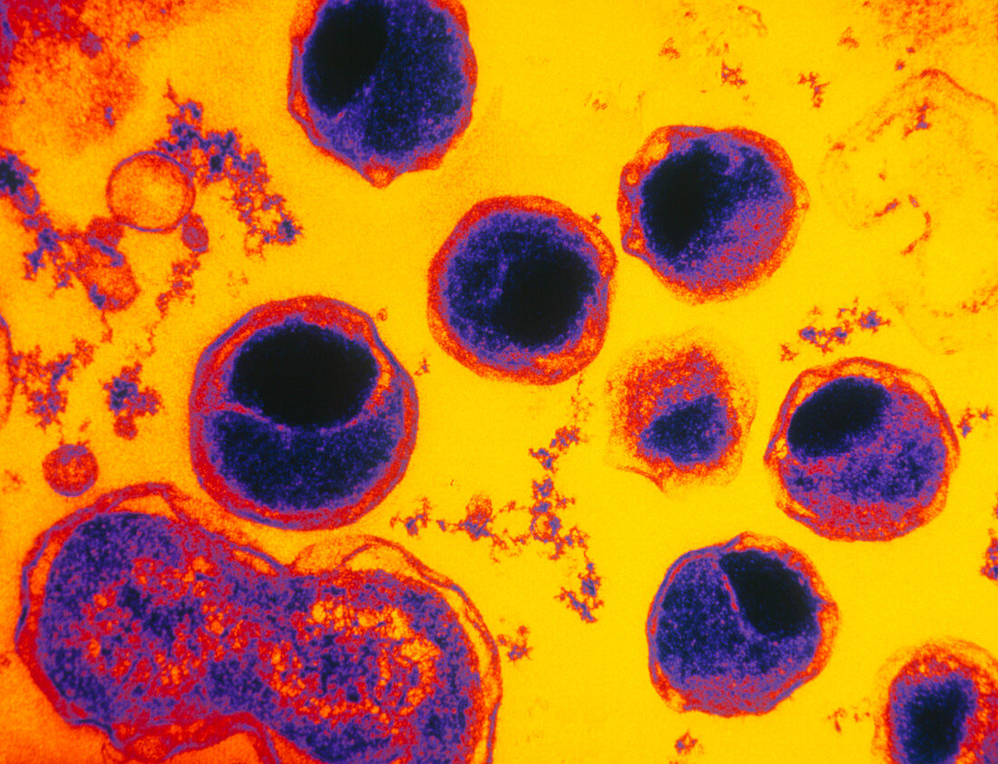 Coloured TEM of Chlamydia sp. bacterium
