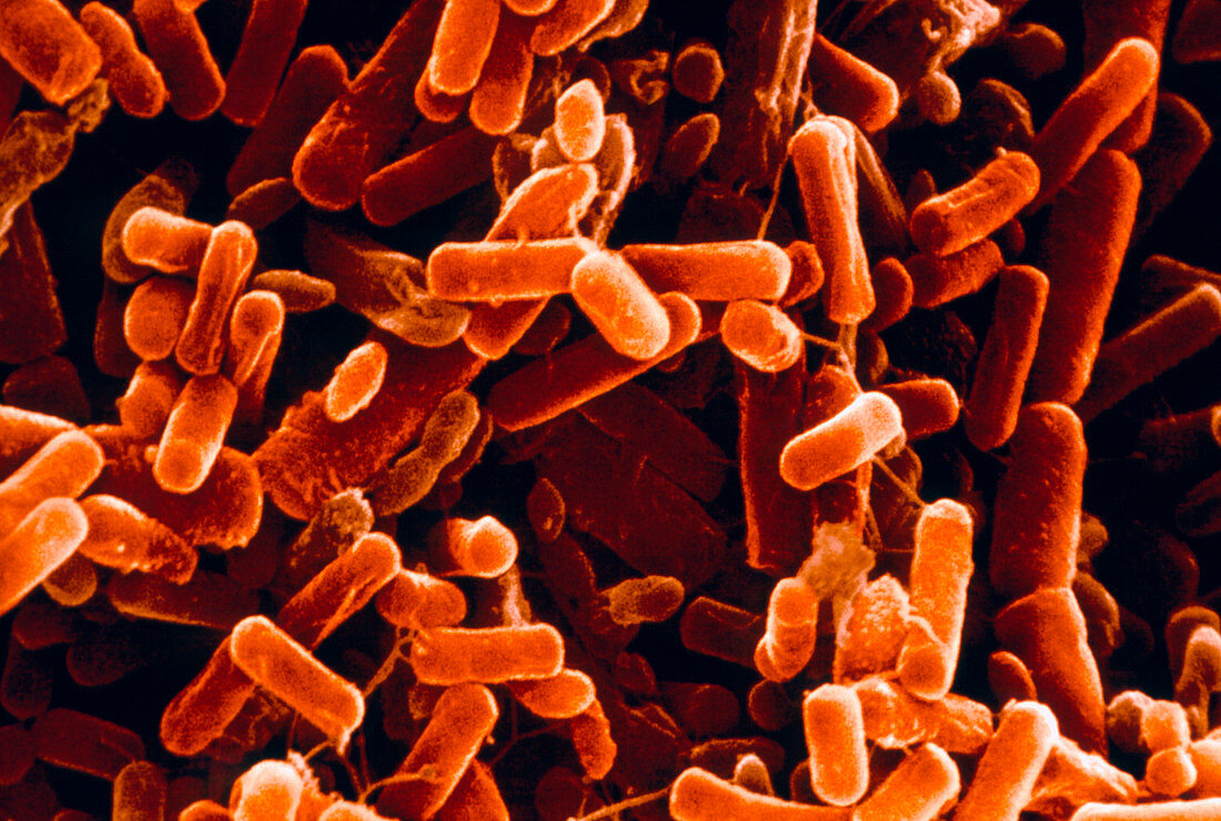 Pseudomonas bacteria in lung