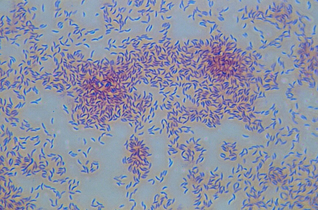 Cholera bacteria