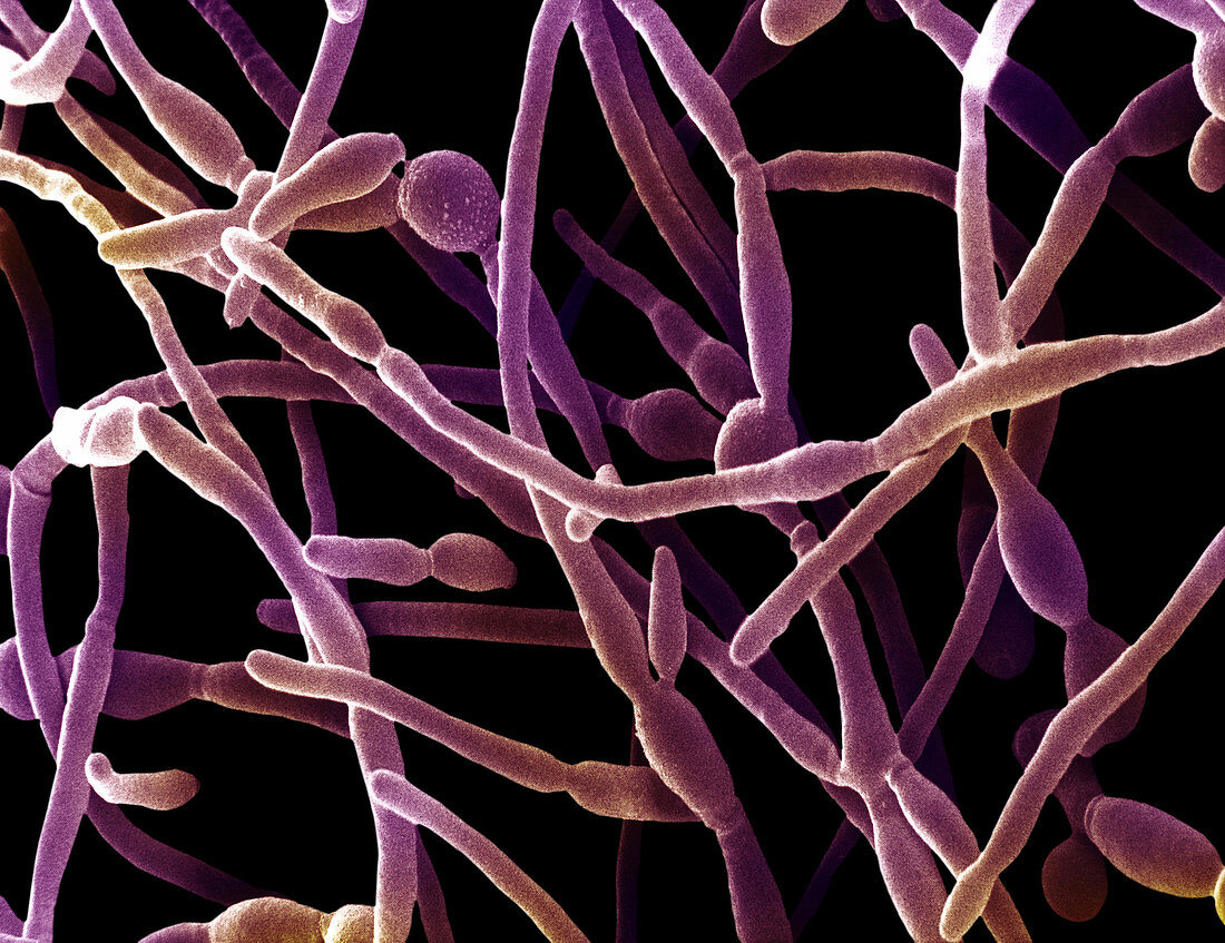 Scanning Electron Micrograph of Candida
