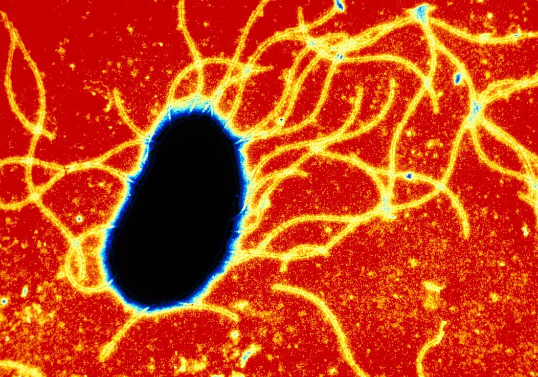 Escherichia coli bacterium