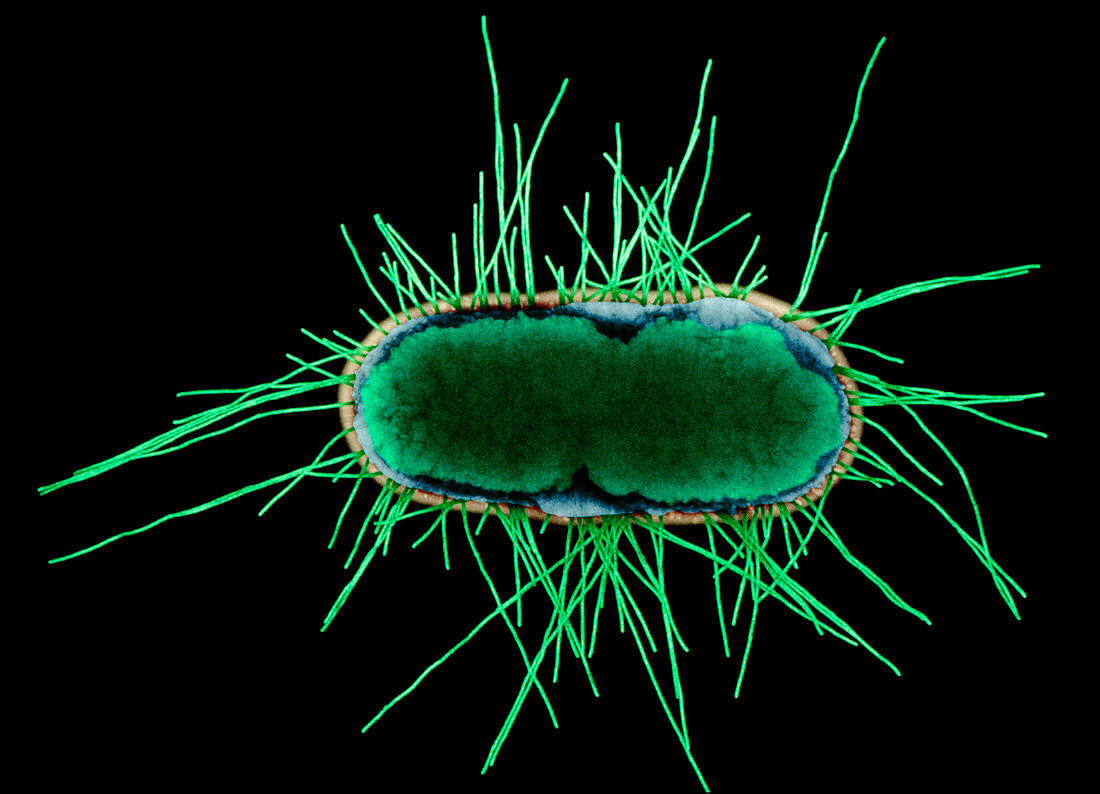 E. coli bacterium,TEM