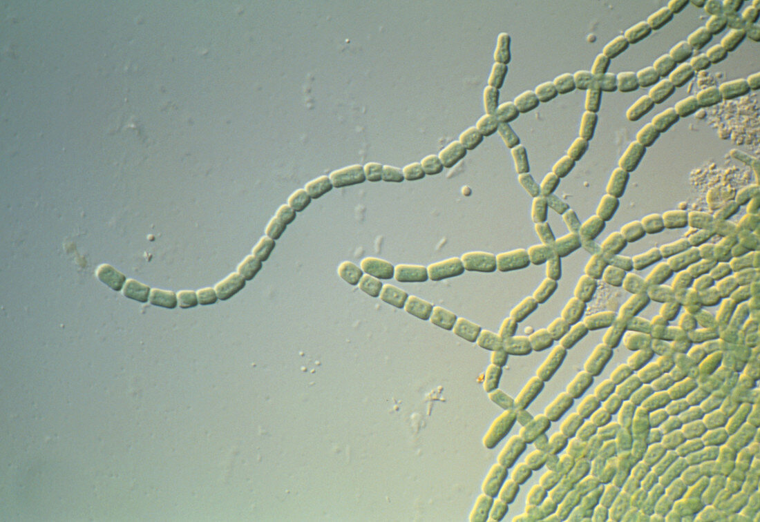 Cylindrospermum blue-green alga