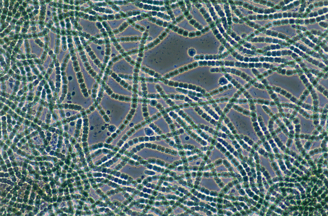 Anabaena blue-green alga