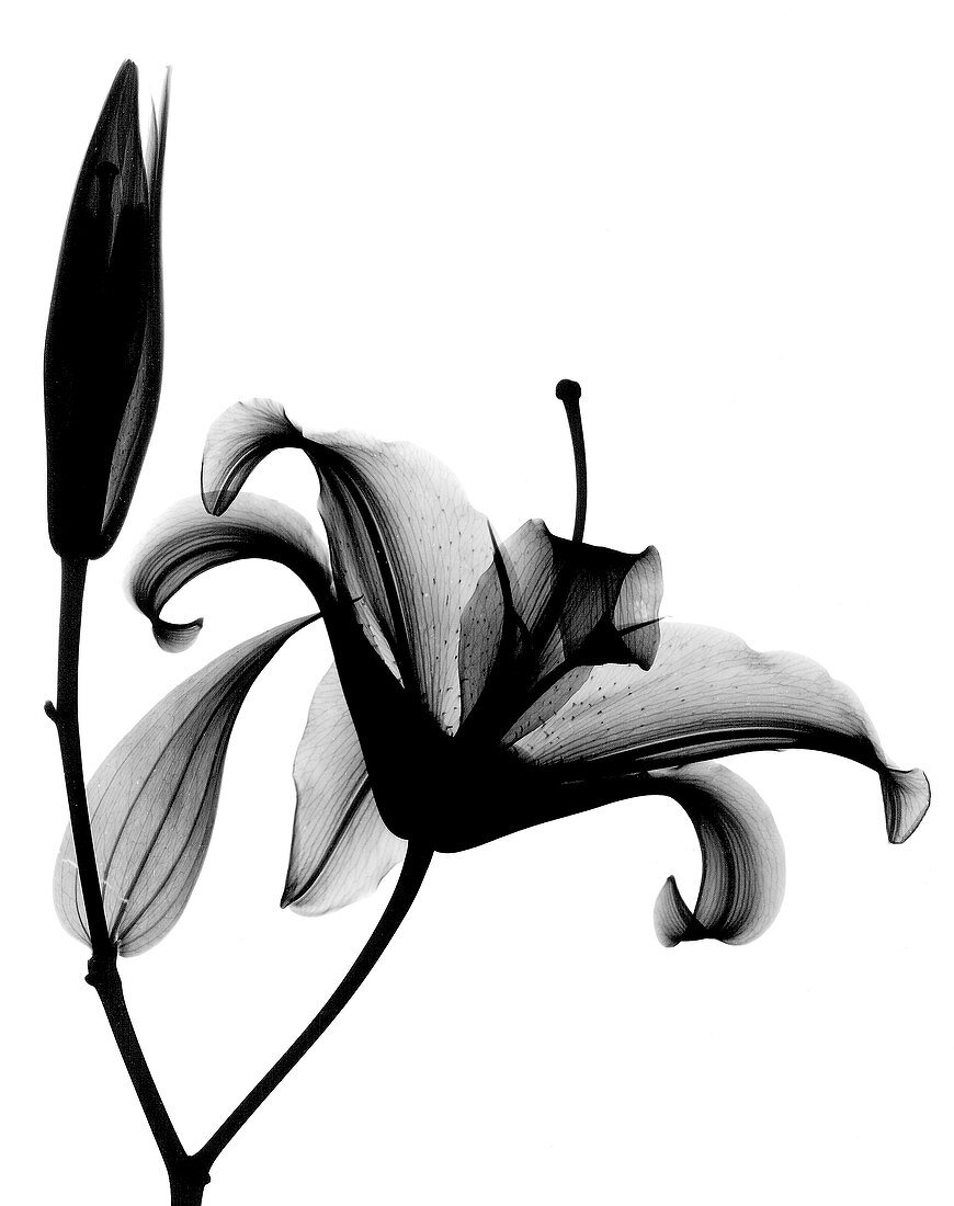 X-ray of a lily