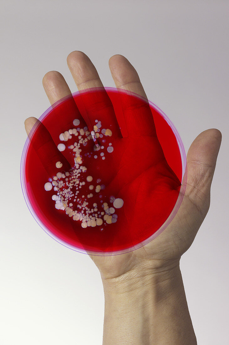 Bacteria Found on Hands