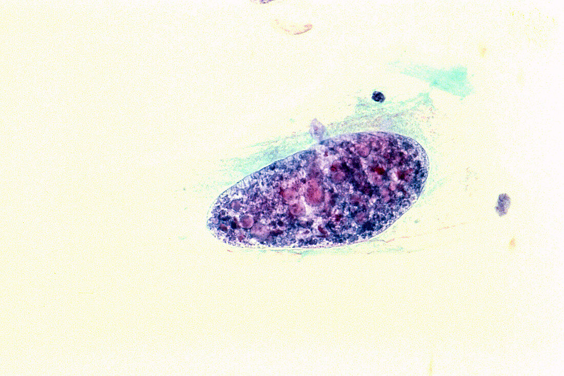 Histiocytoma
