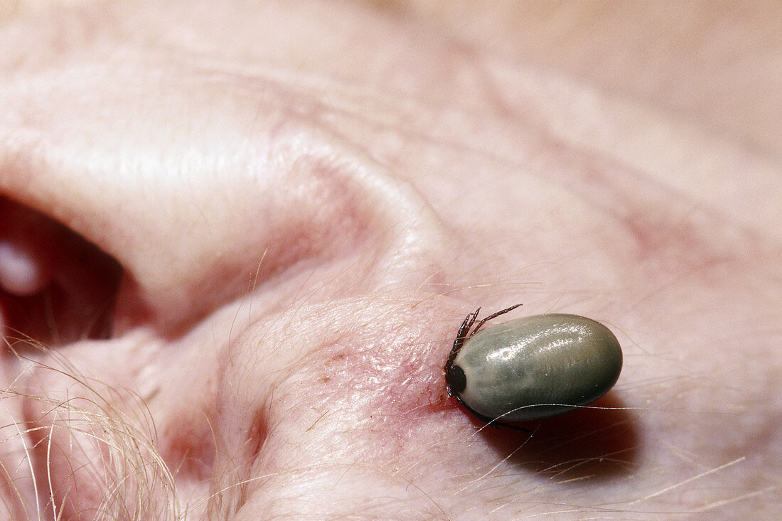 Black-legged Tick