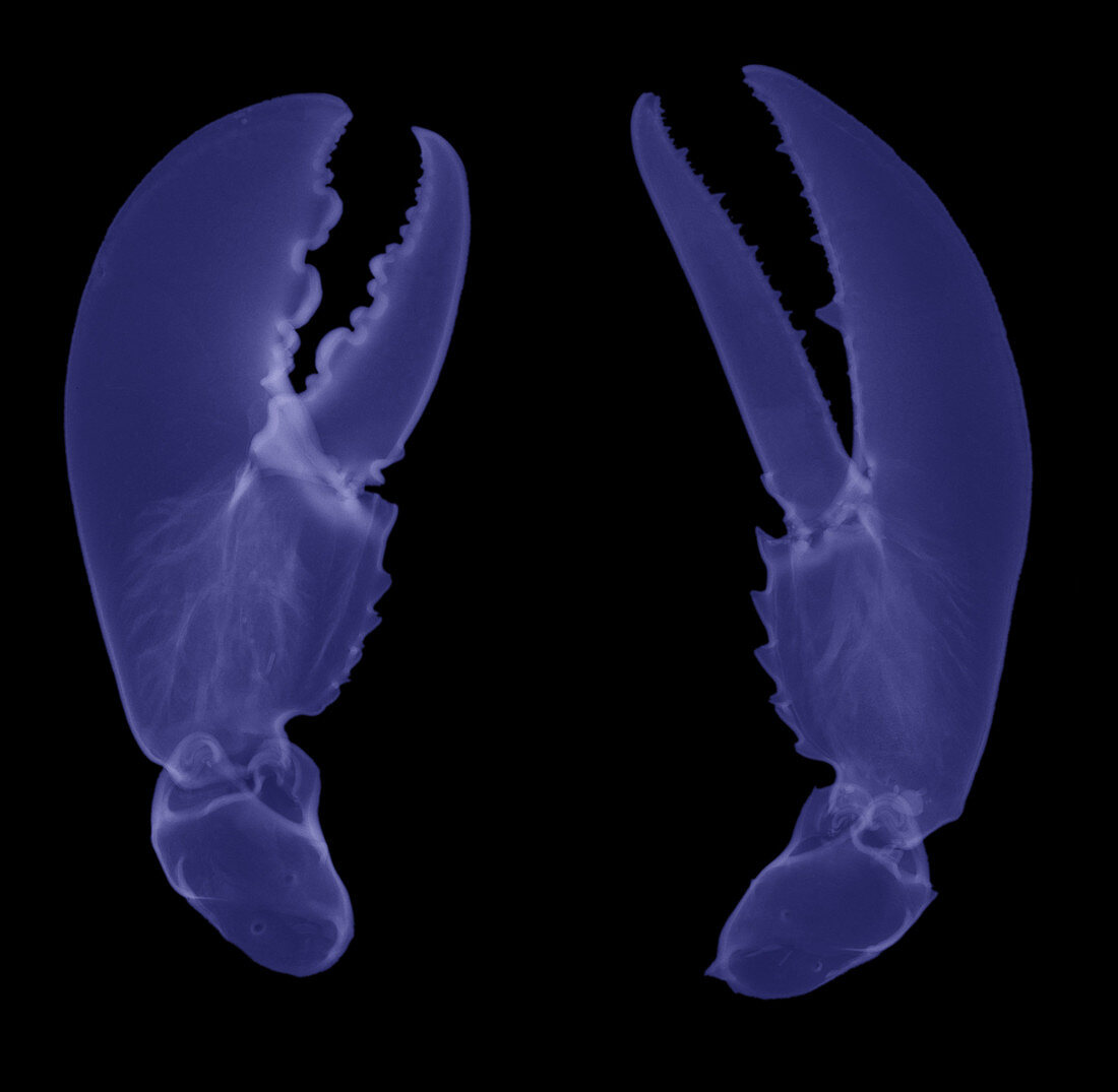 'Lobster Claws,X-Ray'