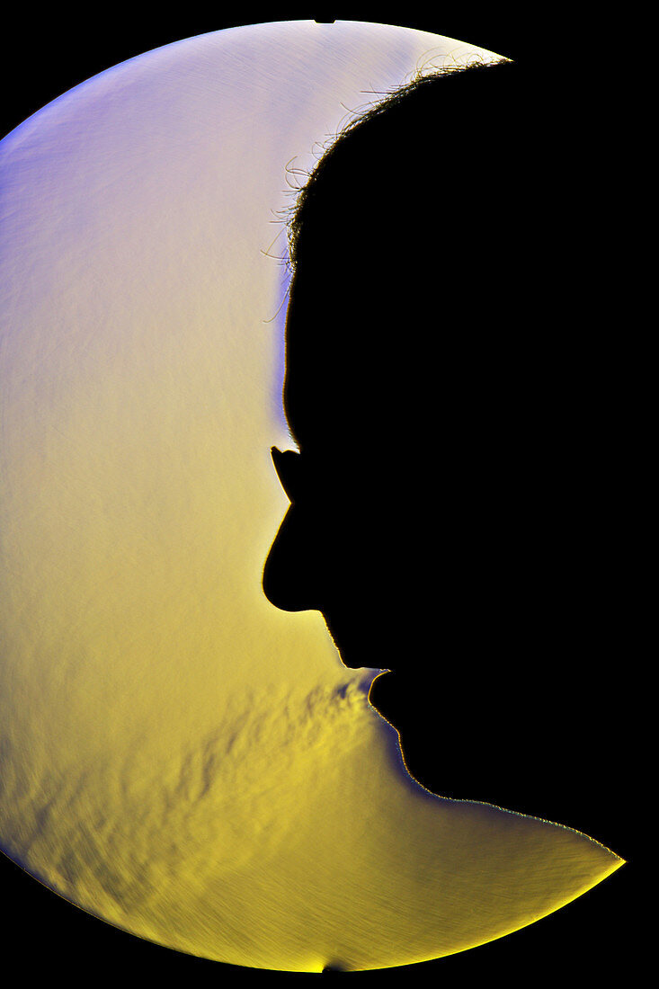 Schlieren Image of a Man Mouth-Breathing