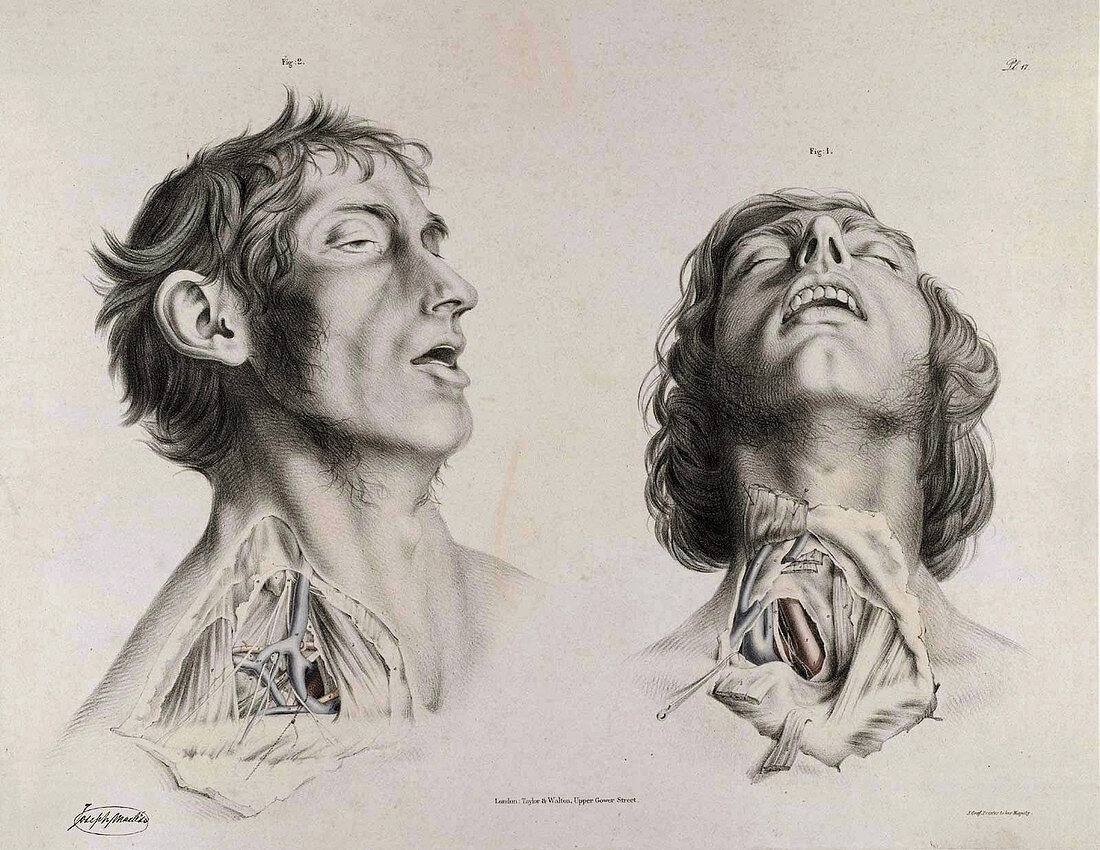 Historical Anatomical Illustration