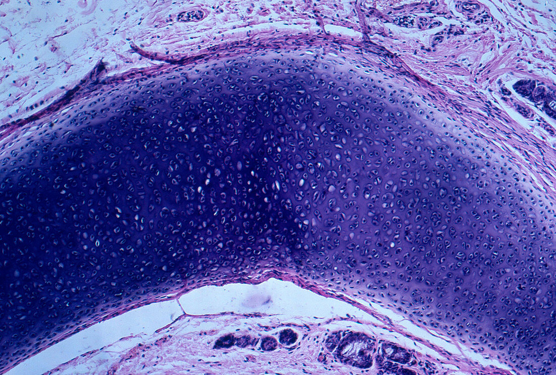 Hyaline Cartilage