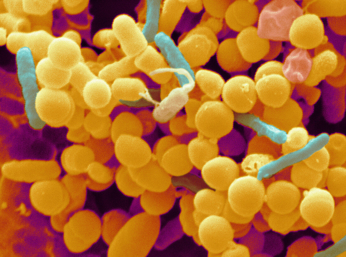 Urinary Bacteria Biofilm SEM