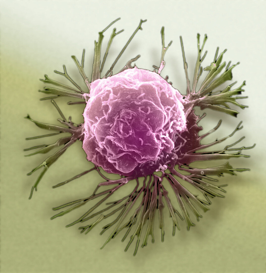 'Breast Cancer Cell,SEM'