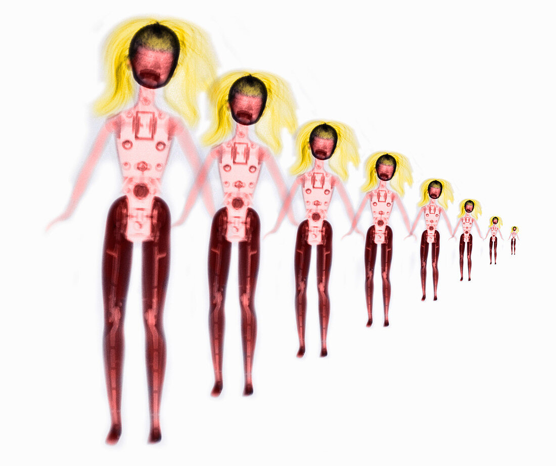 X-ray of Barbie Dolls
