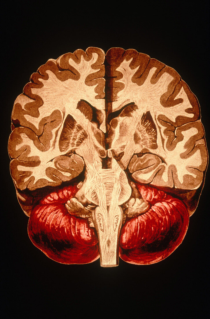 'Brain,Coronal Section'