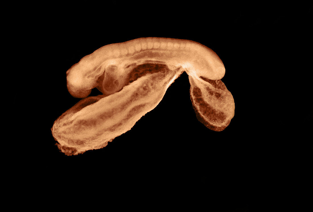 23 day old human embryo