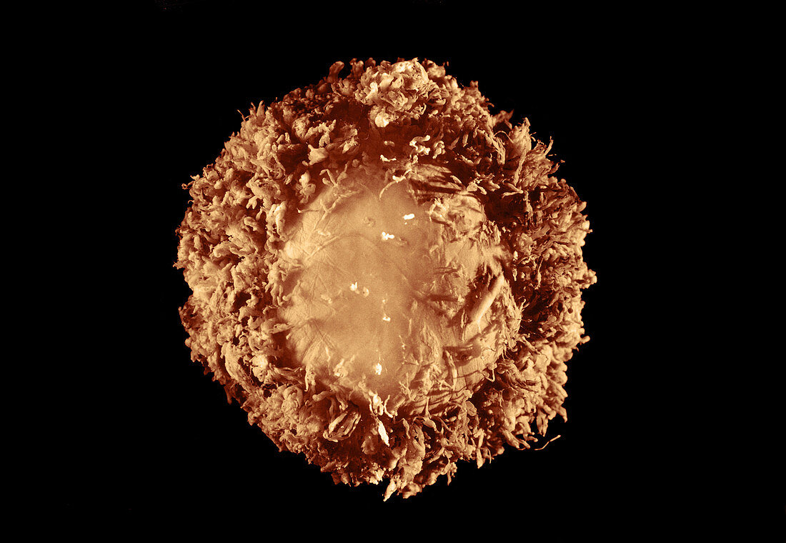 28 day old human embryo