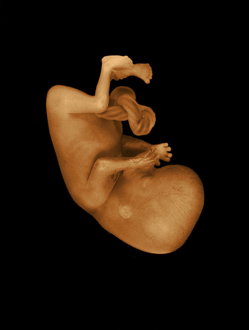 13 week old human fetus