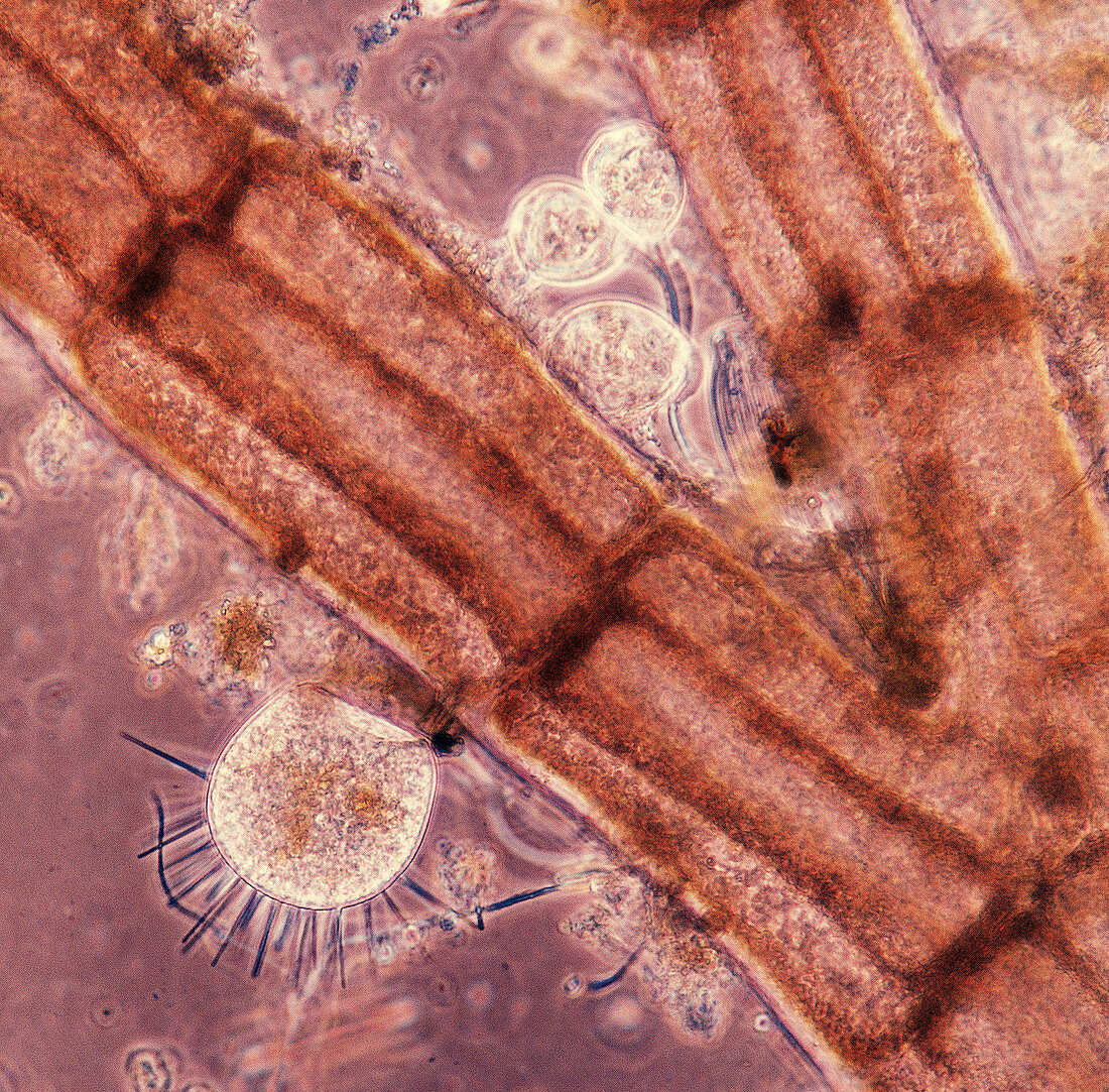 Suctoria on Red Algae