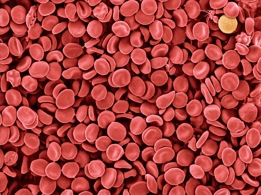 'Red Blood Cells,SEM'