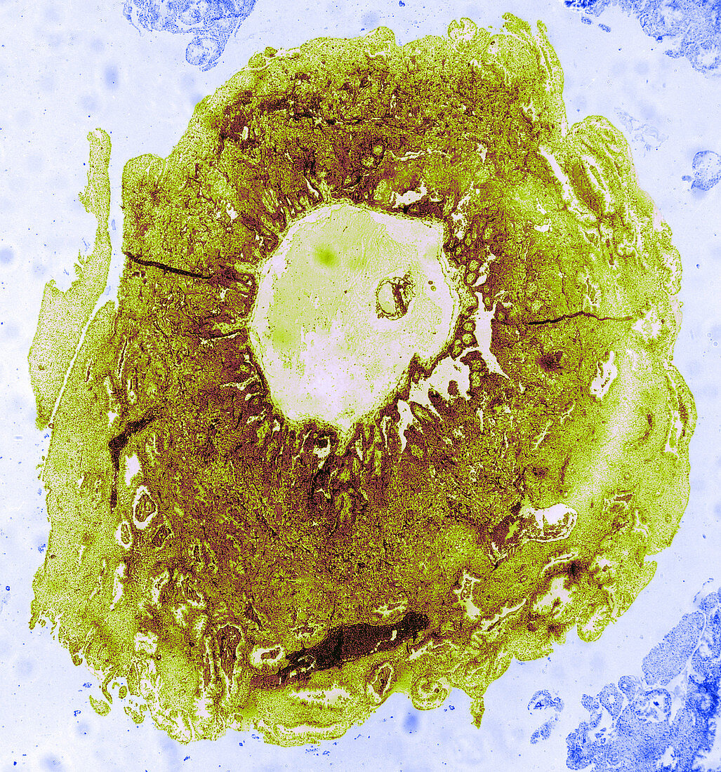 TEM of Human Ovum