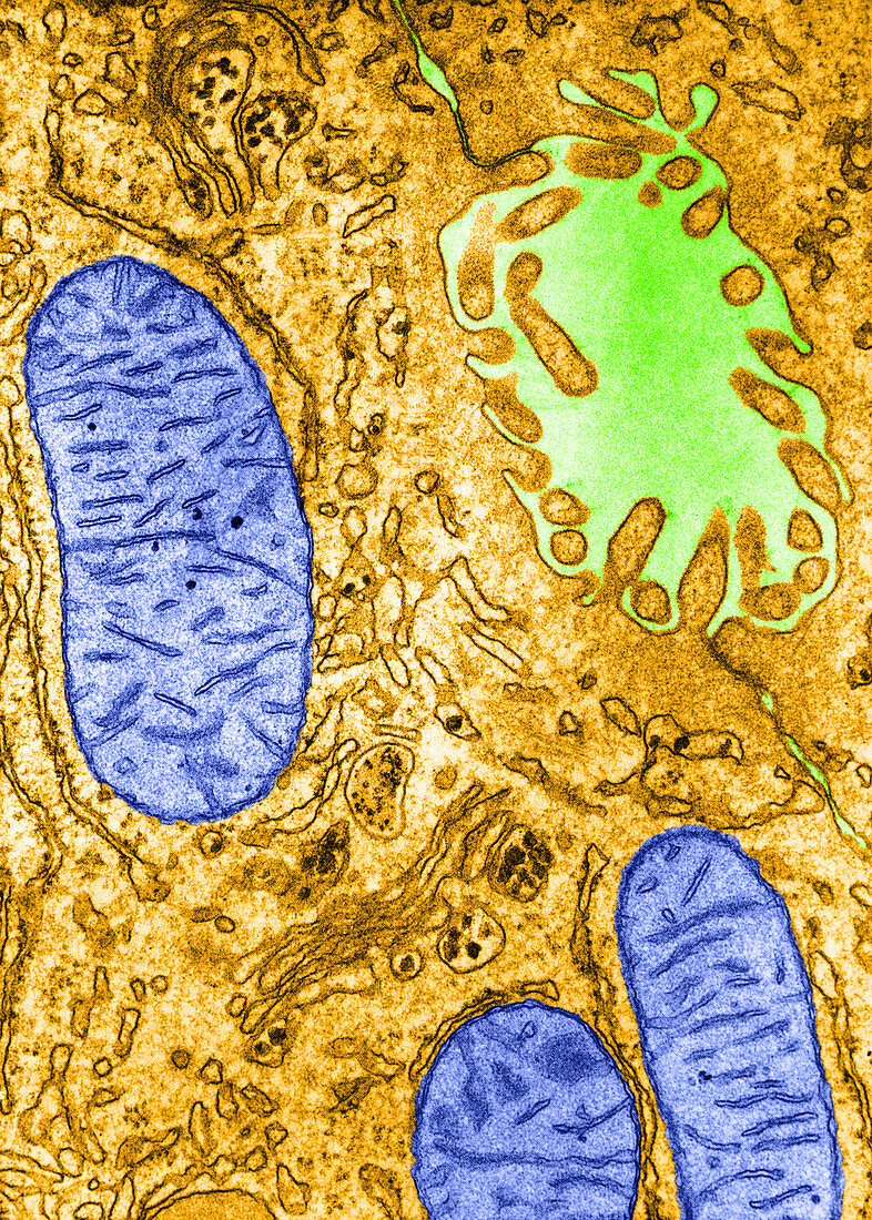 'Golgi Cisternae,TEM'
