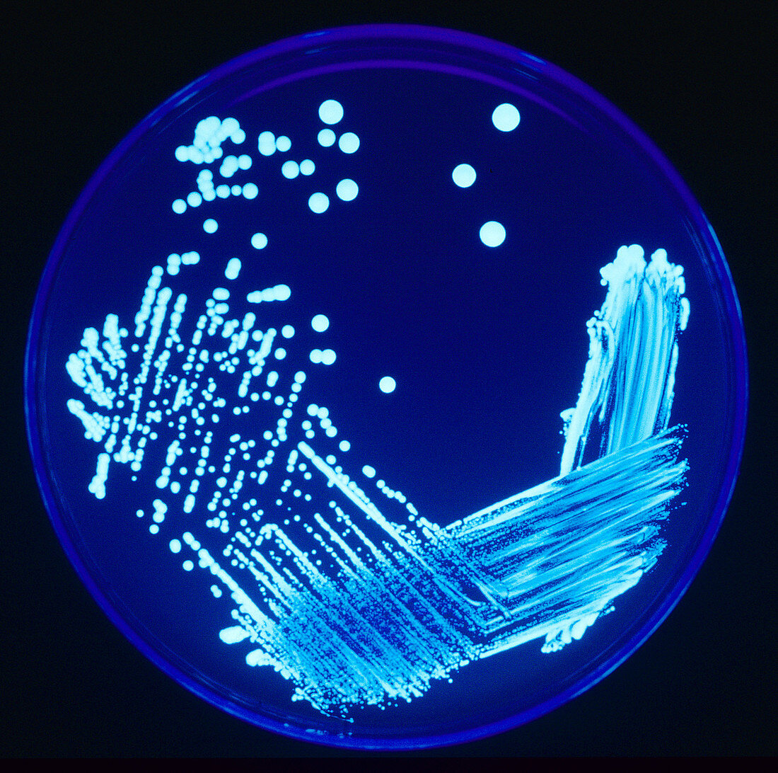 Legionella sp. cultured