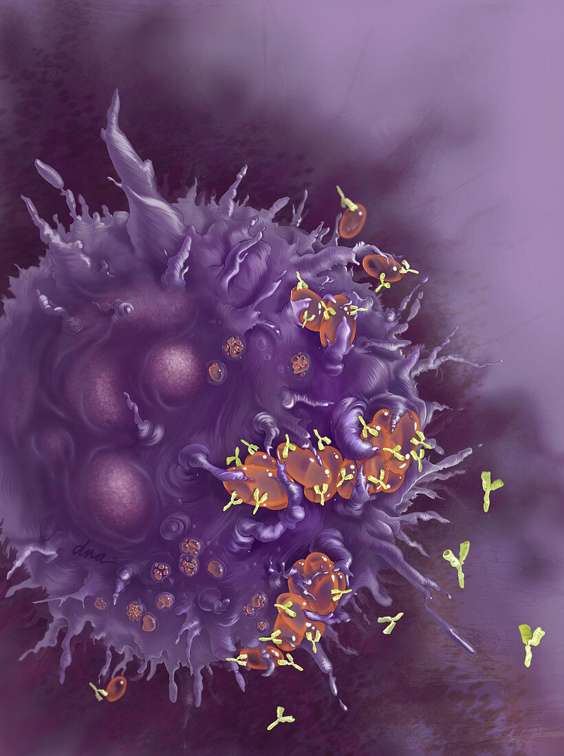 Immune Thrombocytopenic Purpura