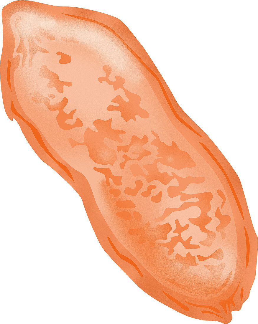Schistosoma