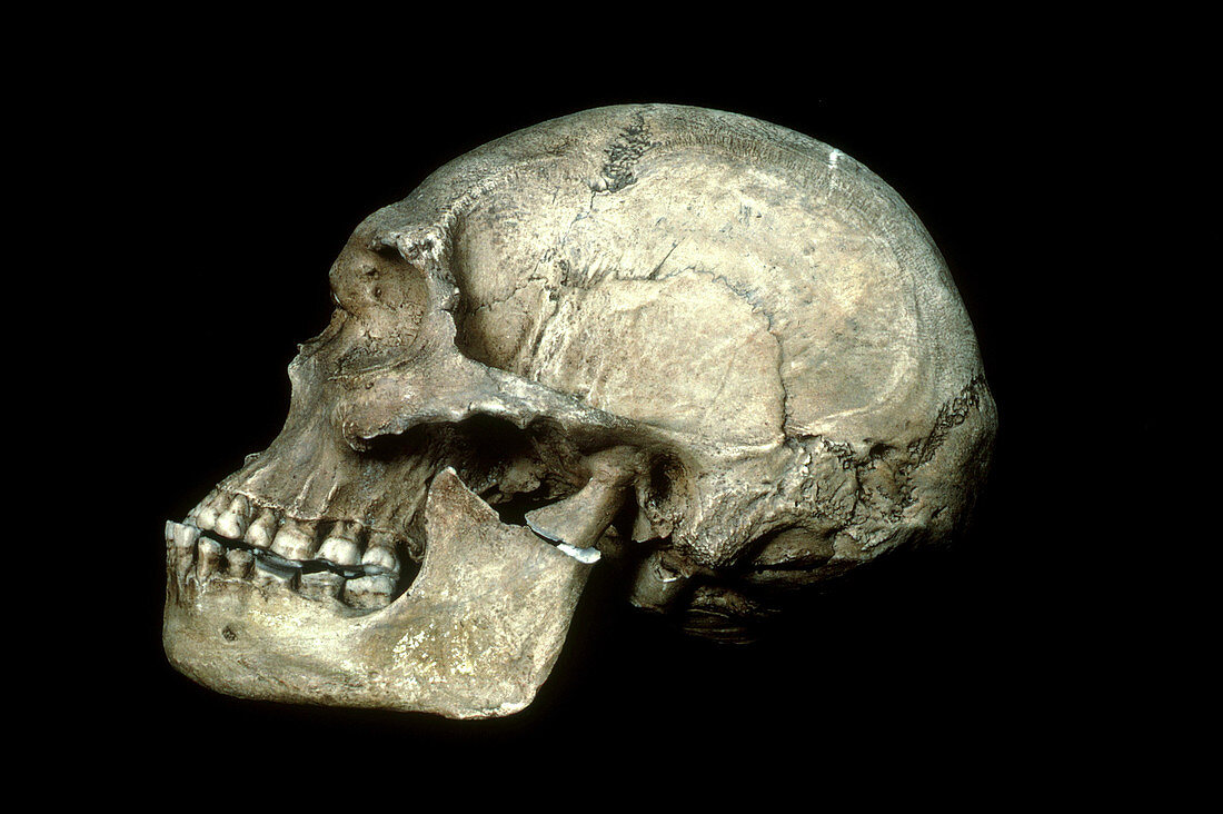 Australian Aboriginal Male Skull