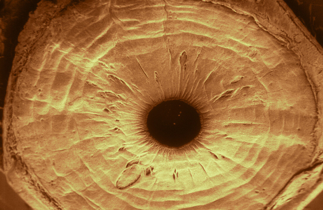 Anterior Surface of Iris,SEM