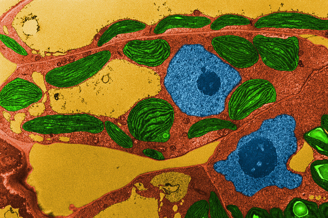 Chloroplasts TEM
