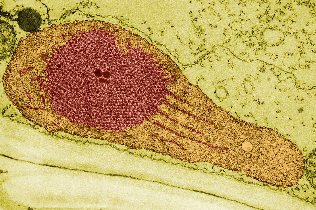 Developing Chloroplast and Etioplast TEM