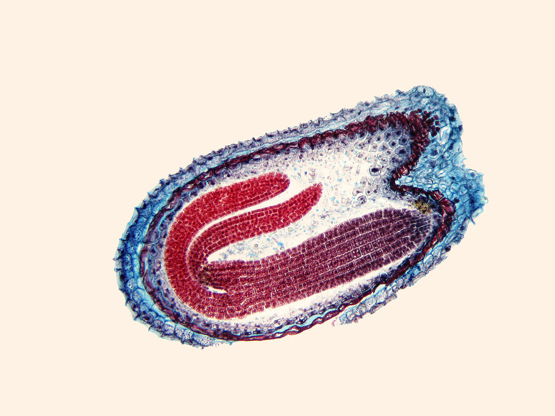 Capsella sp. Embryo (LM)