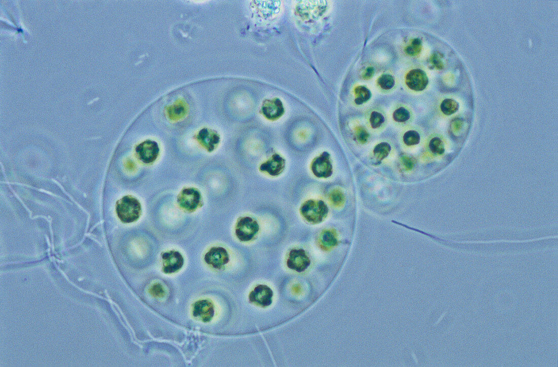 Eudorina californica Algae (LM)