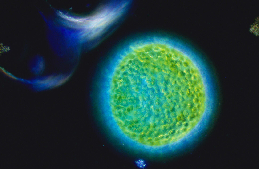 Eremosphaera viridis Algae (LM)
