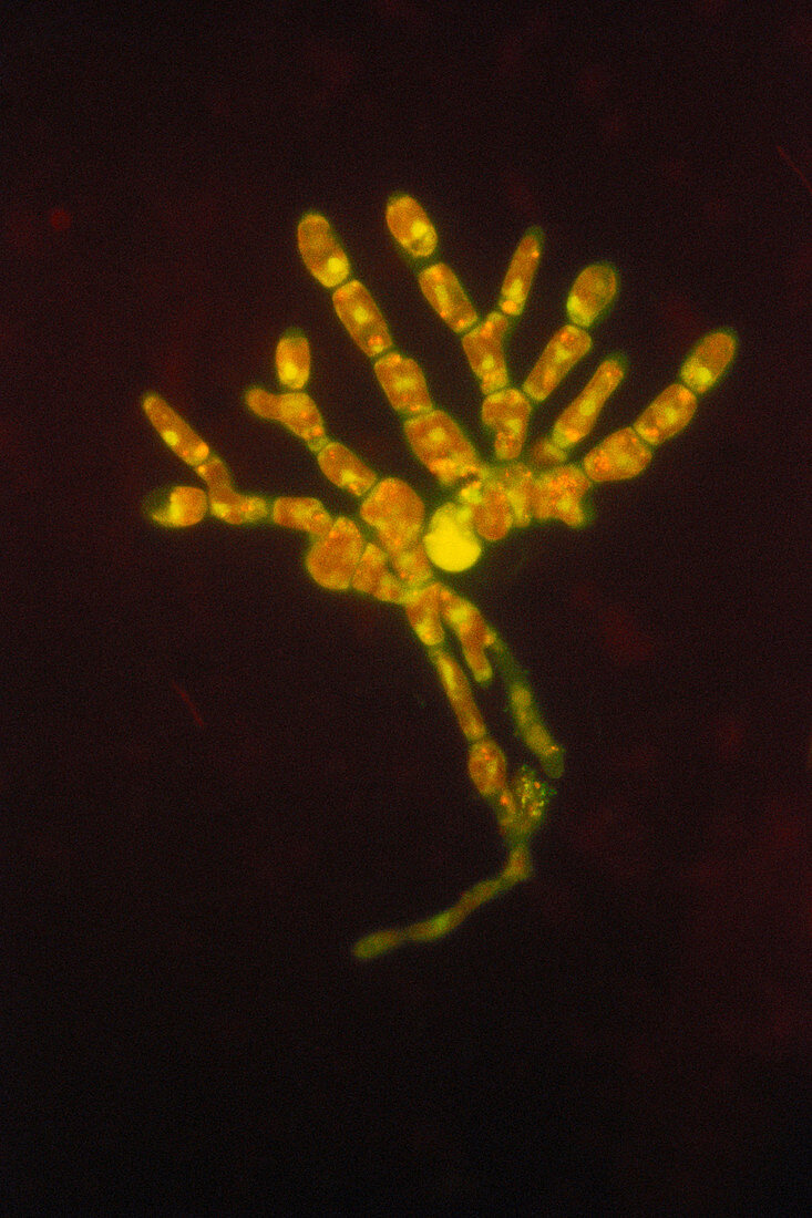 Trentepohlia sp. Algae,LM