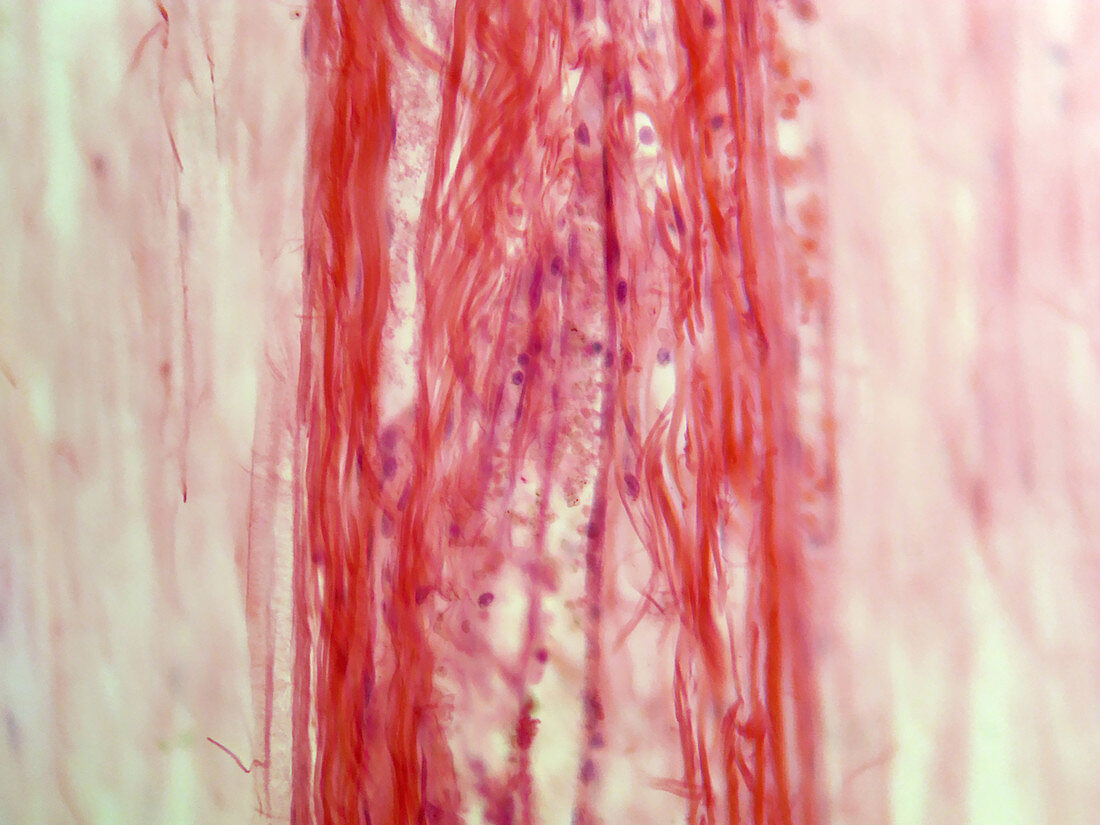 Sciatic Nerve of Cat (LM)