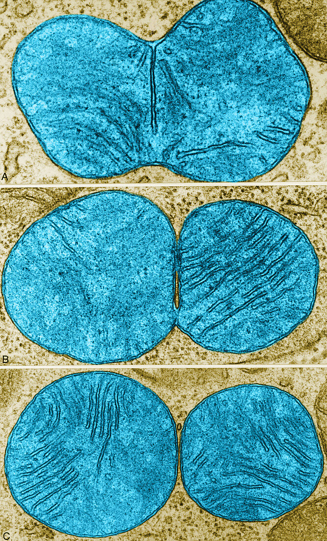 Stages of Mitochondrial Division,TEM