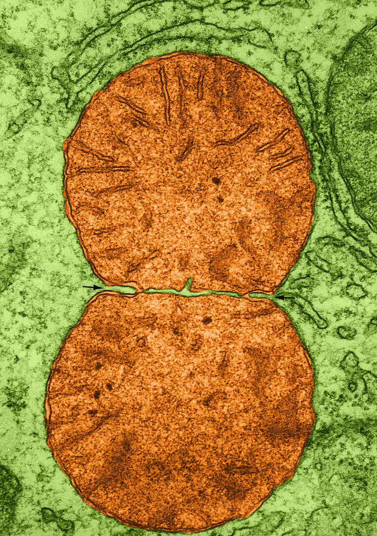 Dividing Mitochondrion,TEM