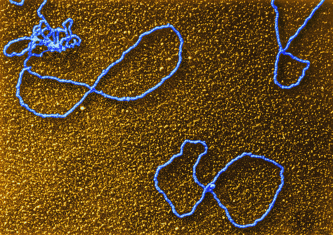 TEMs of DNA and Reaction