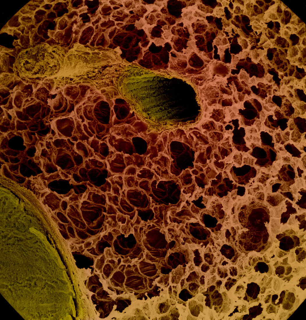 Spongy Tissue,Human Lung