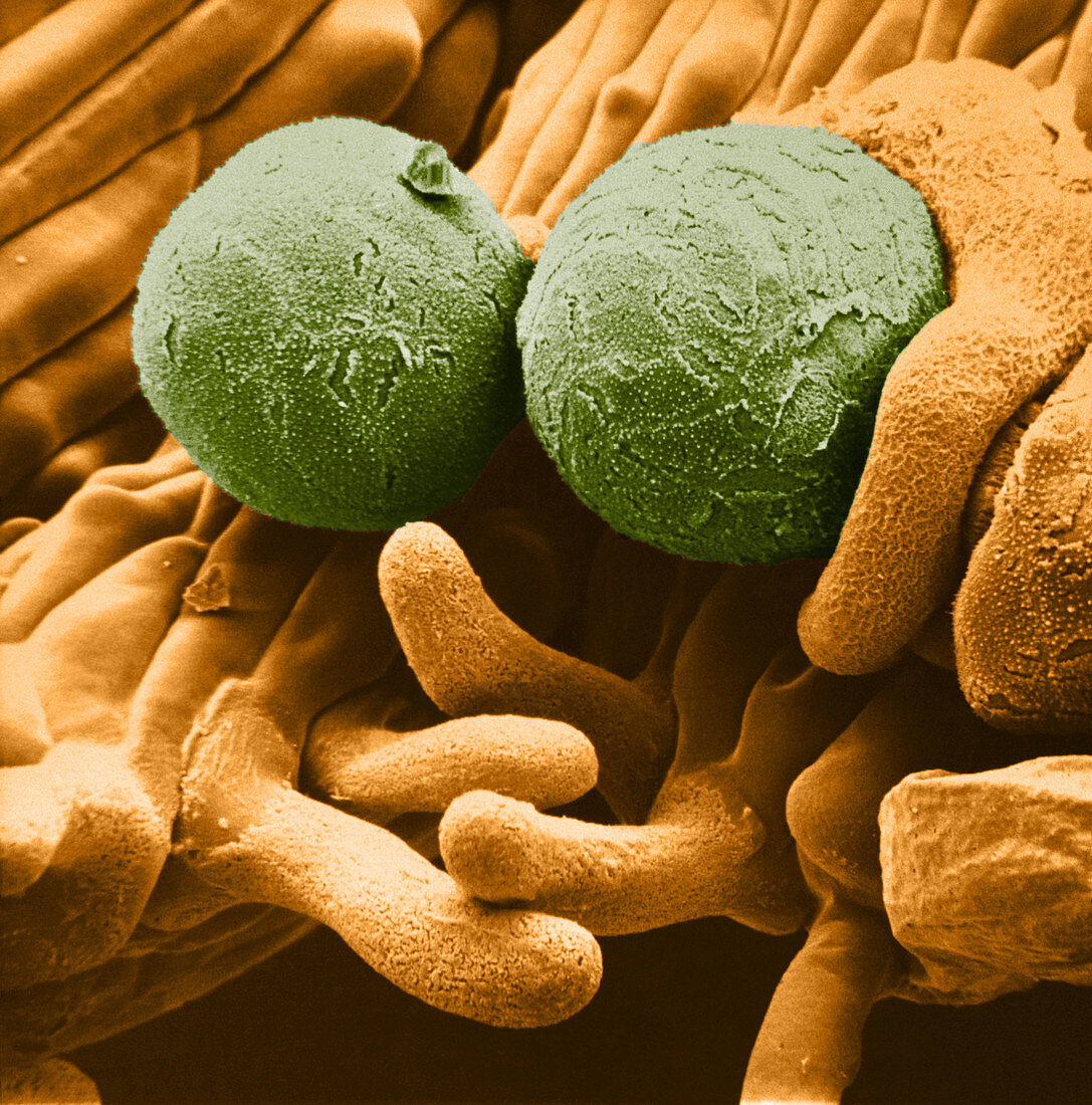 Crocus Pollen Grains on Stigma (SEM)