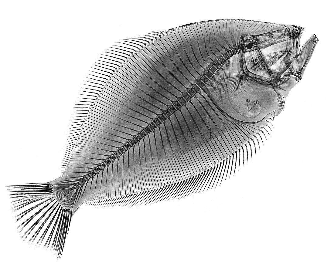 Flounder X-ray